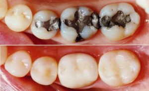 Tandlæger Tandbehandlinger Tandeftersyn tandbehandlinger jagtvej101