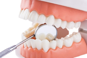 Tandlæger Tandbehandlinger Tandeftersyn tandbehandlinger jagtvej101